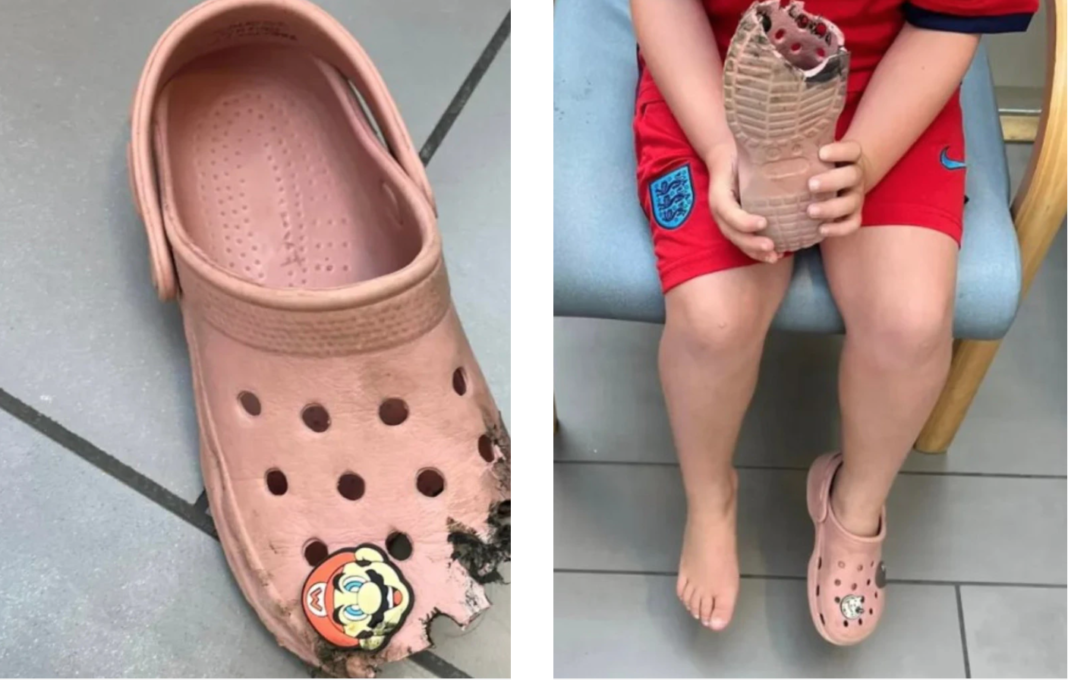 Ja arsyeja pse nuk duhet të vishni Crocs në shkallë lëvizëse